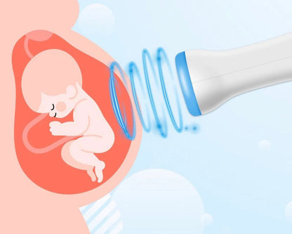 DOPPLER PŁODU (BABY WATCHER) DOMOWY ULTRADŹWIĘKOWY DLA KOBIET W CIĄŻY
